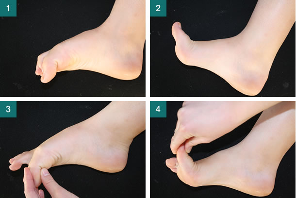 Cheilectomy Movement Exercises