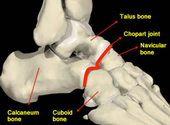 Hindfoot Bones